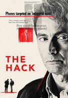 The Hack