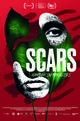 Scars